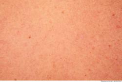 Photo Textures of Human Skin